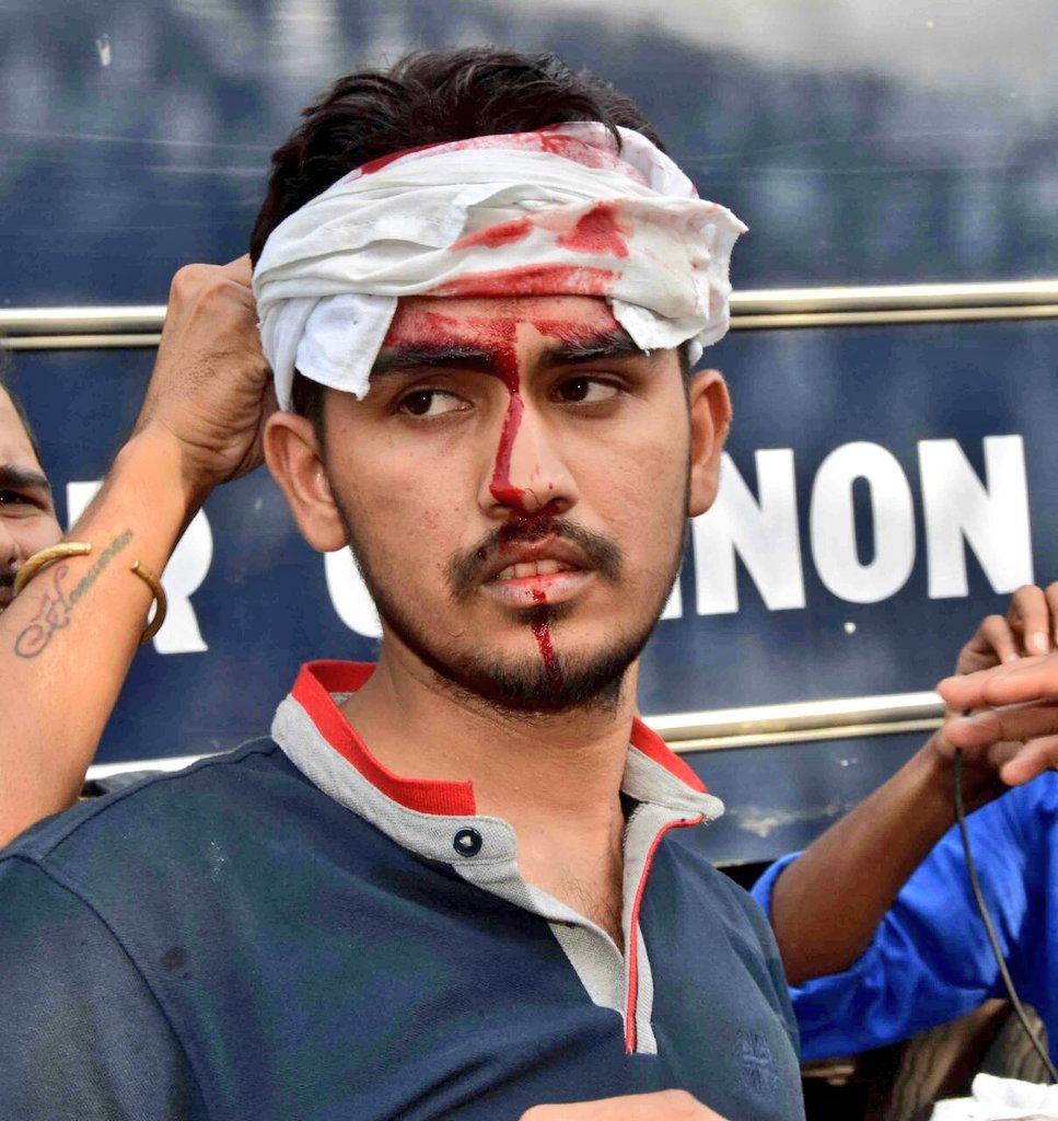 im_pooja18's tweet photo. @hemantrajora_ @_YogendraYadav @kavita_krishnan @yadavtejashwi @smitaprakash @LambaAlka @rajeshmahapatra #SSCExamScam:After today's protest police's #laathicharge,students to continue #YuvaHallaBolall over the country They say if govt can give us clean exam system Union Minister @DrJitendraSingh should resign The movement schedule to be released on14April  https://t.co/SJyQgu6XMB