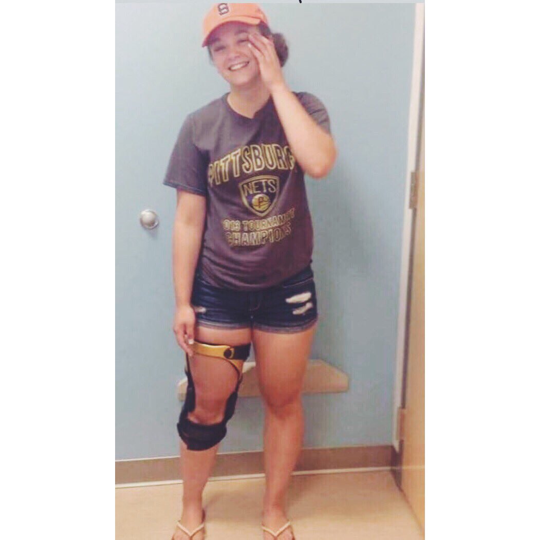 BurtchLily's tweet photo. One Year Out of Surgery!!!! March 31st last year. I love my knee!!!!!! #ACLvictim https://t.co/xBJuJ8DkkK