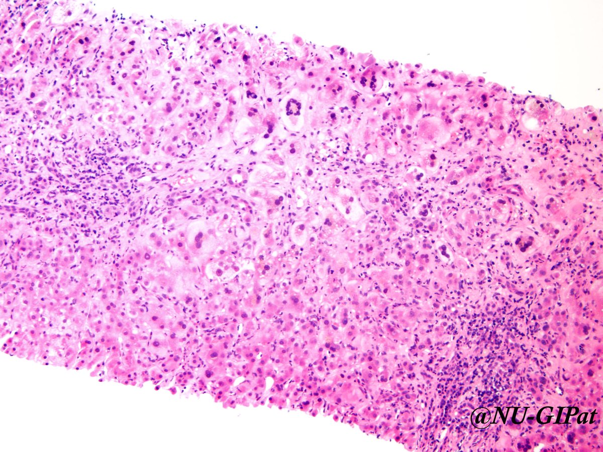 zithromax rxlist