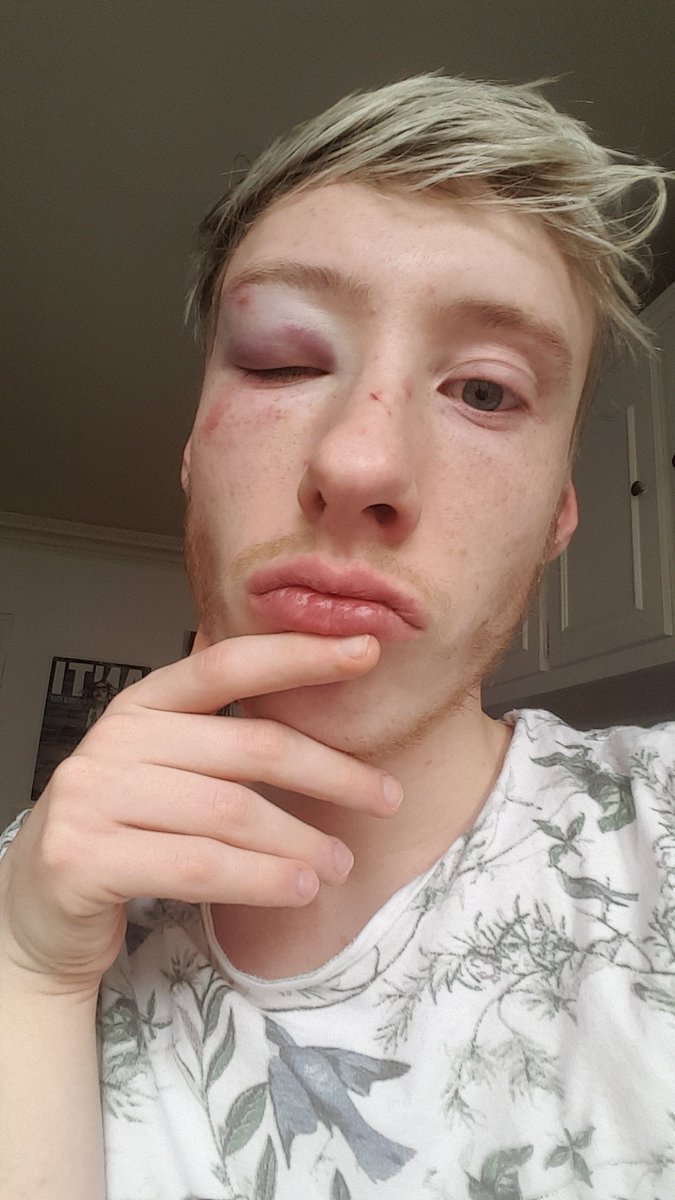 MDeliere's tweet photo. Et mercé mon beau visage. France. Homophobie. 2018. https://t.co/A7qB8Mm5V2