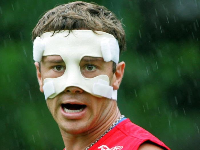 Diego Lugano (@DiegoLuganoOk) com a máscara de proteção, após ter fraturado o nariz jogando pelo <a href="/SaoPauloFC/">São Paulo FC</a>.