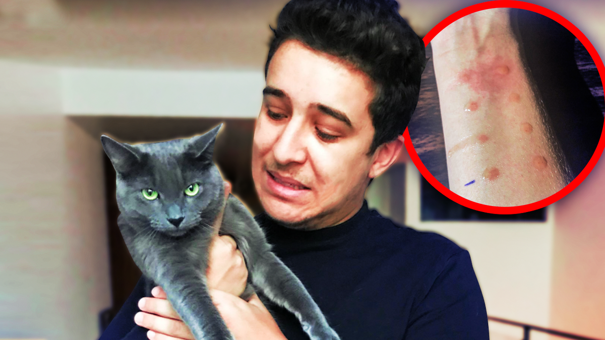 Aiekillu's tweet image. Bonjouuuuur! Nouvelle vidéo sur ma chaîne dans laquelle je vous raconte comment je suis devenu allergique aux chats ainsi que les solutions qui m'ont été proposées #RT

youtube.com/watch?v=j4Zw3e…