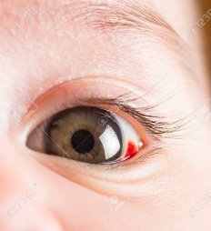 CooperVisionCZ's tweet photo. https://t.co/AuNYMTFWEN https://t.co/POh6ZKzQTW