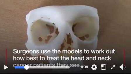BBCRadioManc's tweet photo. A new 3D printer at North Manchester General Hospital is saving between £3-5000 per patient. It's used in resconstruction surgery, especially for head and neck cancer patients. It helps speed up surgery and reduces the amount of time under anaesthetic. https://t.co/uDQCN53pW2
