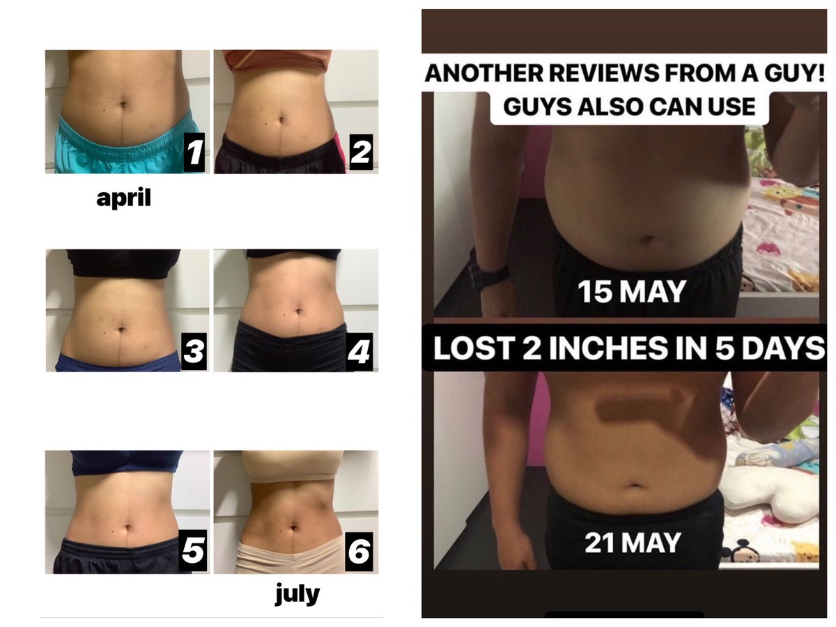 chongandromeda_'s tweet photo. 100% real reviews, 100% natural ingredients, 100% safe &amp; effective

no diet | no exercise | no surgery | no pain/burning sensation | no rebound

pm me or head to my ig @ 4ndr0m3d4_ for never ending reviews!

say bye to flabby arms, thunder thighs, tummy &amp; even your double chin!💯 https://t.co/rGO4BX8MOY