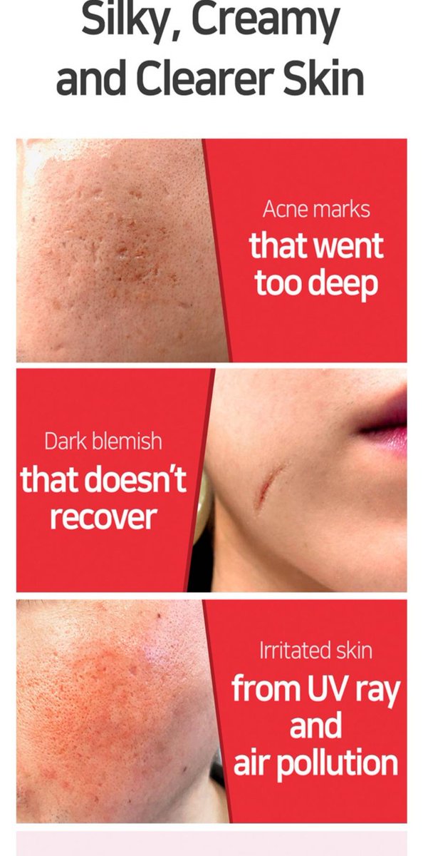 Orderme_plz's tweet image. SOME BY MI : SNAIL TRUECICA REPAIR SERUM  ปริมาณ 50มล
เซรั่มเมือกหอยทากสีดำ ช่วยรักษาผิวที่อ่อนโยน และฟื้นฟูผิวให้สามารถสร้างเซลล์ผิวใหม่ได้ด้วยตัวเอง เติมเต็มหลุมสิว และลดเลือนรอยแผลเป็นต่างๆ 
590฿ รวมส่ง ลทบ
#somebymi