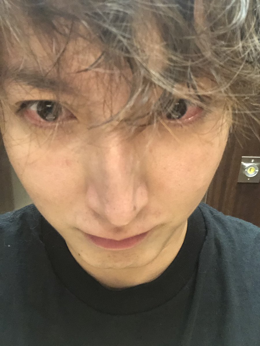 Cr おじじ リテイルローのおじさん A Twitter 無加工で汚くてごめん伝わるかな目めっちゃ赤い実際東京喰種かってくらい赤い俺人間だよね Cr おじじ リテイルローのおじさん A Twitter 無加工で汚くてごめん伝わるかな目めっちゃ赤い実際東京喰種かってくらい赤い俺人間だよね