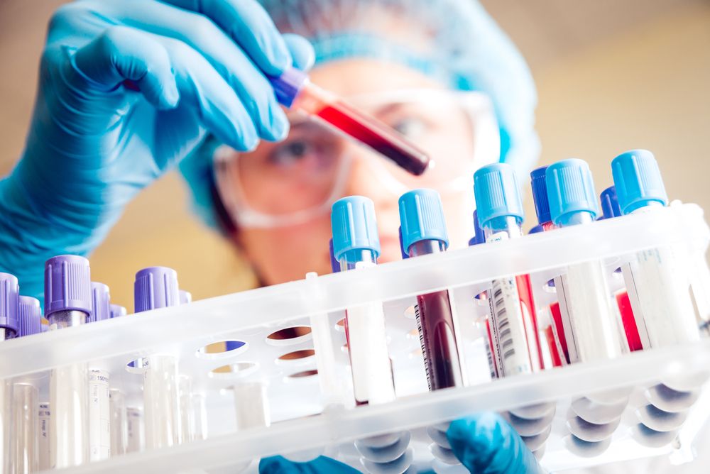 CatchTheBaby's tweet image. Blood Test From @Parsortix Identifies Ovarian Cancer Prior to Surgery, Clinical Trial Planned buff.ly/2M2c5nW

#ovariancancer #smallstudy #liquidbiopsy