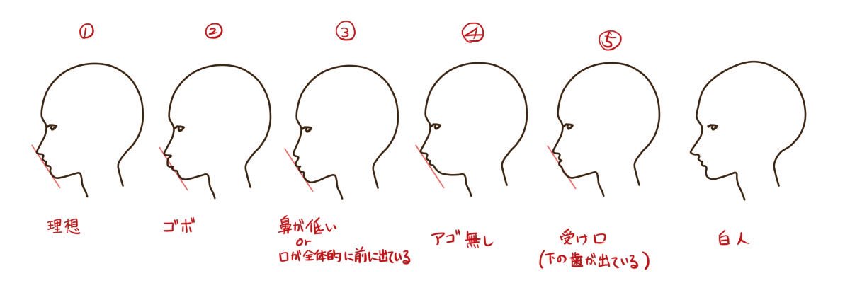 アデノイド 顔貌