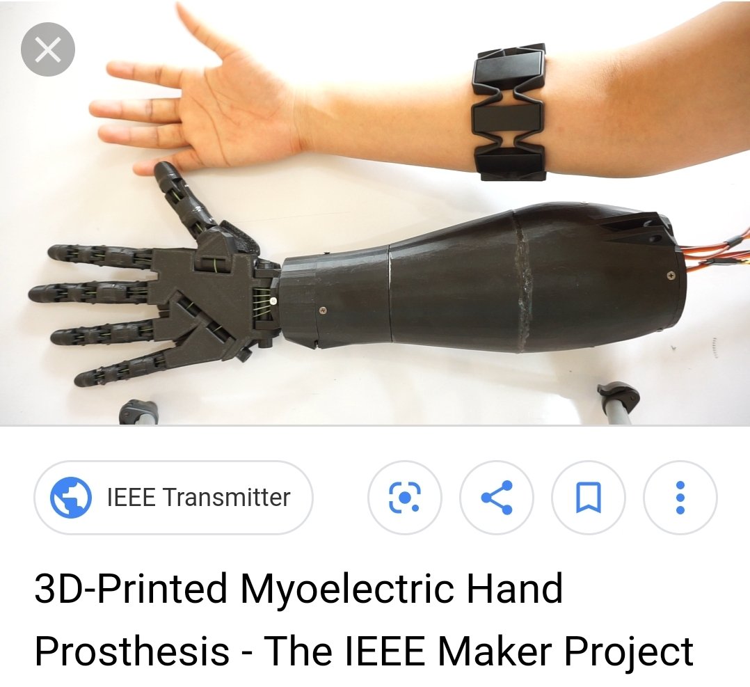 Even the robotic exoskeleton I've been attempting to create (far too slowly) would rely on myoelectric sensors- which requires at least SOME nerve signals be present in order to function