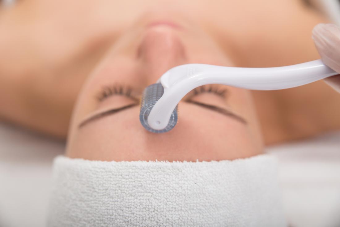 Plastics3650's tweet photo. Secret RF Microneedling Treatments Available in Jefferson Valley, New York
(https://t.co/1eM5js0rWg)

#SecretRFmicroneedling #microneedling #JeffersonValleyNY https://t.co/PXr7PQ57jZ