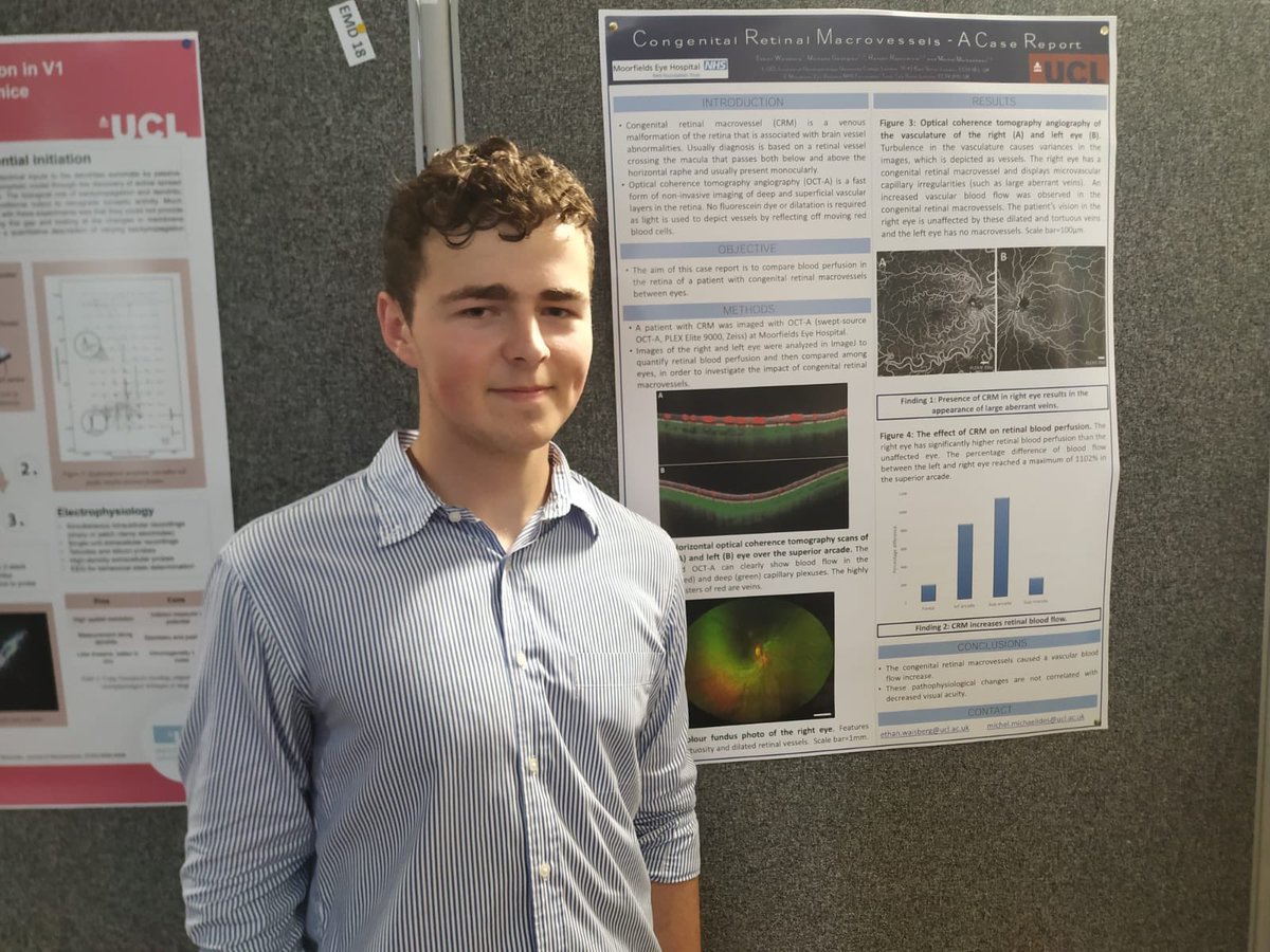 UCL_Retina's tweet photo. Our summer school student Ethan Waisberg presenting his research poster this afternoon. Lots of interest! #StudyVisionUCL https://t.co/WFLyrmJsk5
