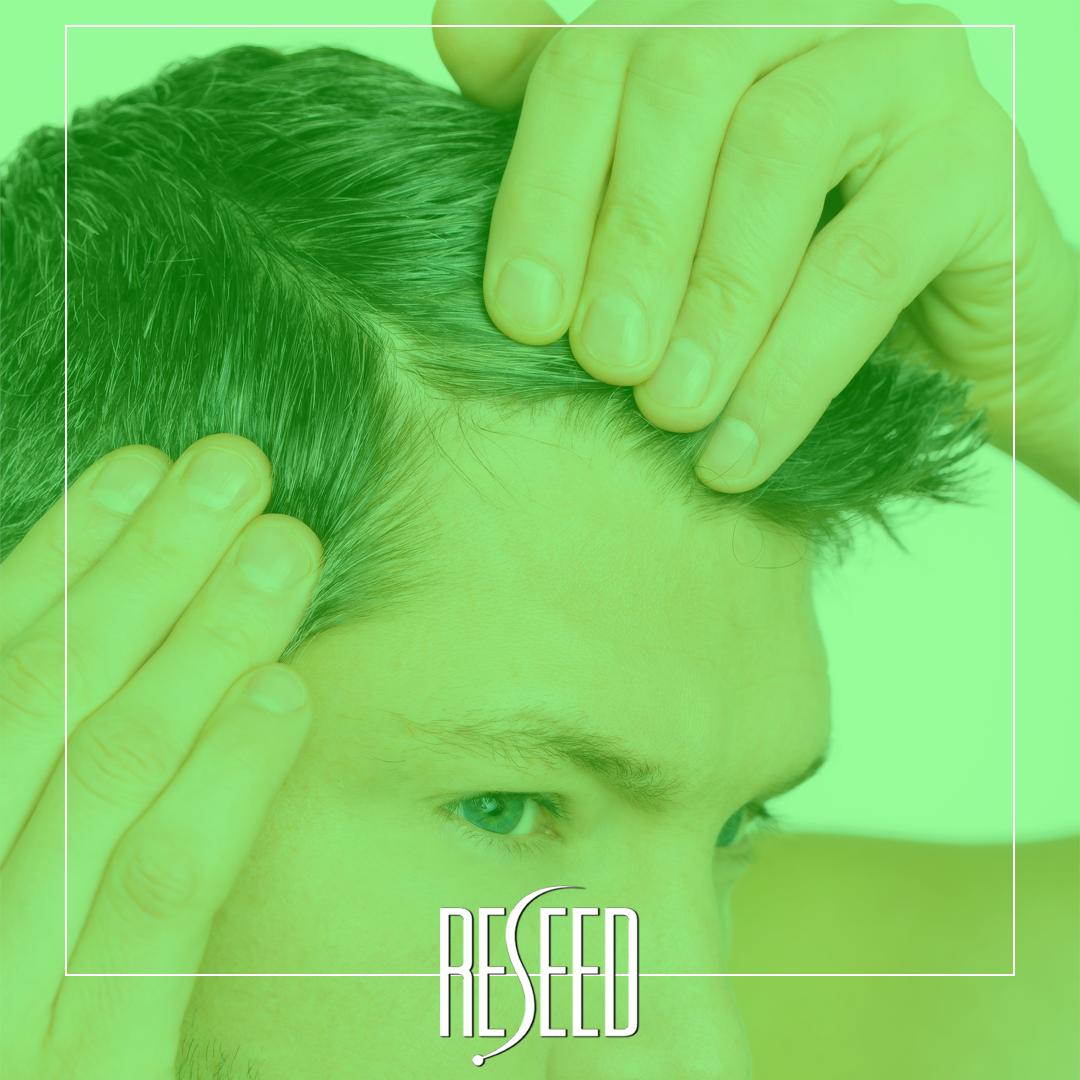 Reseedhair's tweet photo. Apply a few drops of our R12 Active Hair Serum to block the production of DHT, increase micro-circulation and strengthen the hair follicles. Shop now at @RevitalLTD online and in selected stores to get 25% off! https://t.co/7HcHM2M77y
#reseedhair #hairserum #dht #dhtblocker https://t.co/DDEIx30dDD