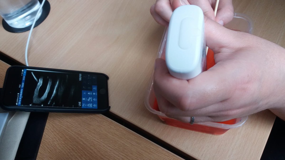 OuraniaVarsou's tweet photo. Testing DIY #US phantoms in the office & cannulating pasta! Thank you so much @BallaterMedical for lending us your wireless US probes! Check the US screen where the needle enters the vessel! @FabQu_ @UofGSoLS @UofGMVLS @UofG_Alumni https://t.co/lhbva58cIl