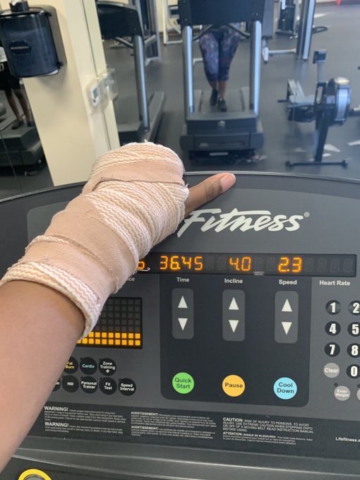 I&rsquo;m ready to rip this cast off 😩 https://t.co/zU99rRVKW1