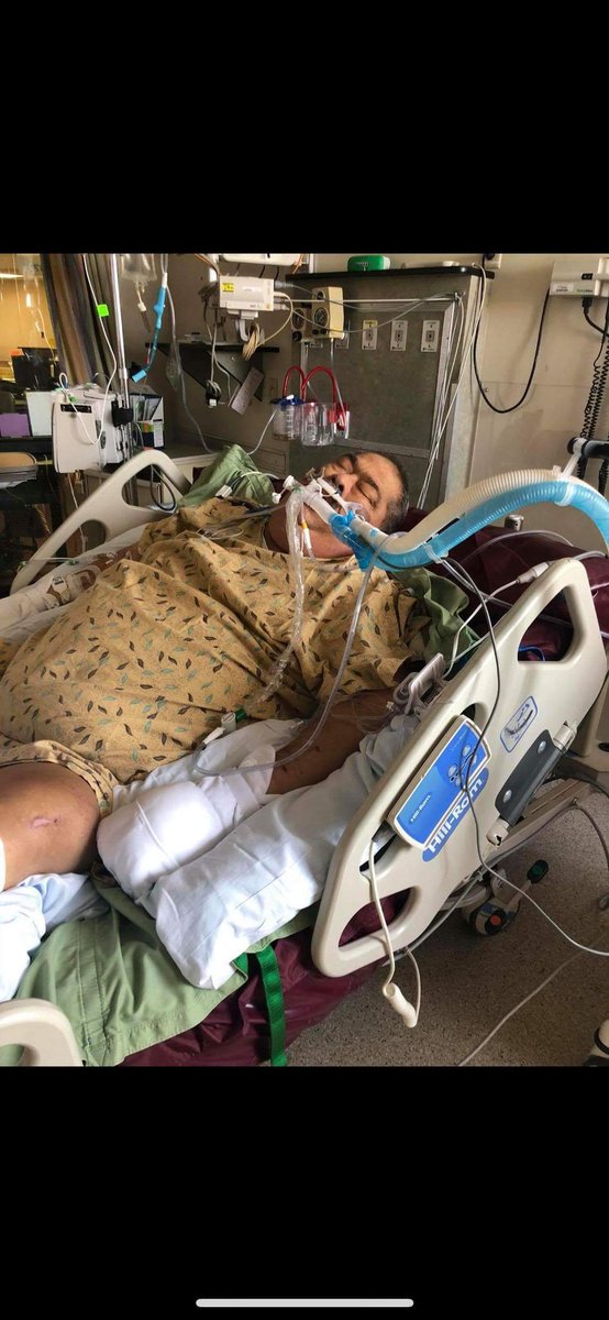 It has been a year that I became totally paralyzed was in a coma for 4 months I had to depend I'm everyone for everything I was like a baby 1 yearly I am still alive I am working hard to recover and I will show you the progress