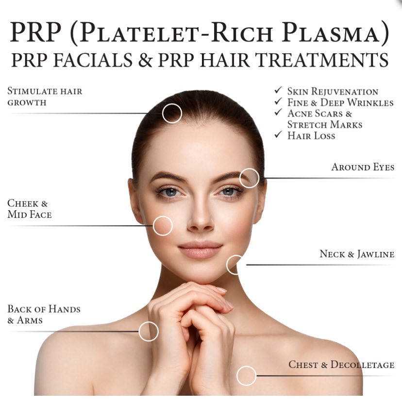 Platelet rich plasma (PRP), commonly known as the #VampireFacial. The process sounds scarier than it really is, but what's most shocking is the beautiful results that are created! Learn more here: qoo.ly/ynxes