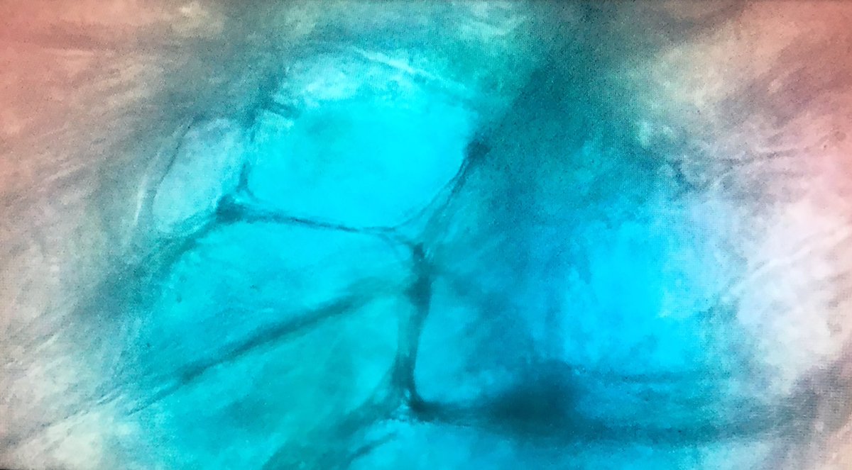 fraga_eddy's tweet image. Sample images captured with my #openflexure