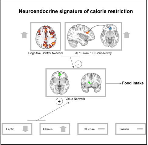 CSPgym's tweet photo. 'Losing weight is challenging, although keeping the weight off is the real challenge, but It is possible to do. Recent research adds to the existing pile of science showing the important link between your brain and your weight loss efforts.'

https://t.co/23OOda87UI https://t.co/dp1OvWT1Lw
