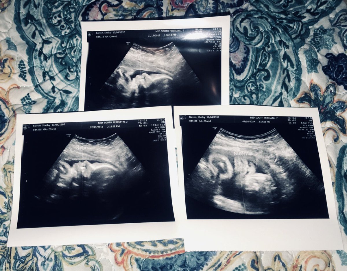 shellycbelly's tweet photo. Update on my Decklan Gray 💙 https://t.co/NE2JhnSaHa