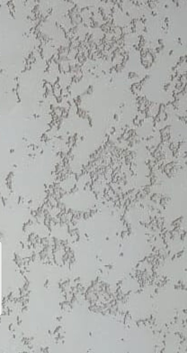 One of are distressed concrete finishes