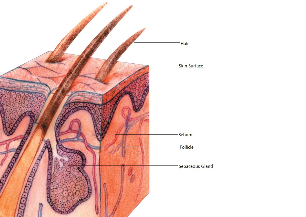 Image: An illustration of a normal hair follicle and surrounding structures, including hair, skin surface, sebum, follicle, and sebaceous gland.