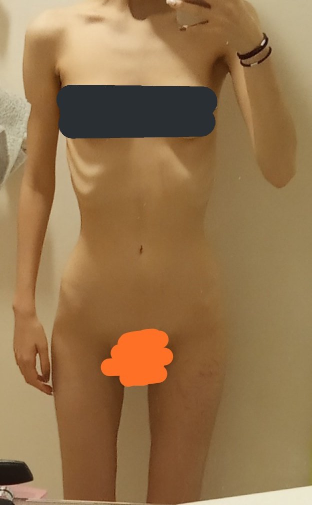POTAT0_ES's tweet photo. Chaque jour est un combat pour moi mais je suis vraiment heureuse de voir l'évolution entre ces deux photos. https://t.co/1gDoQgLrJ3