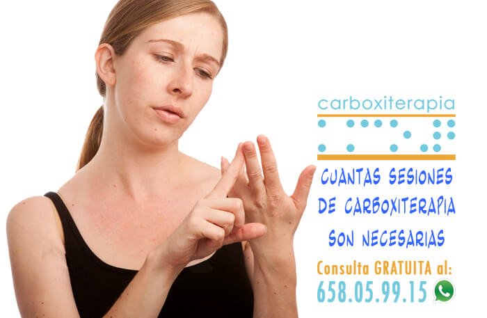 Inyecciones de carboxiterapia cuantas