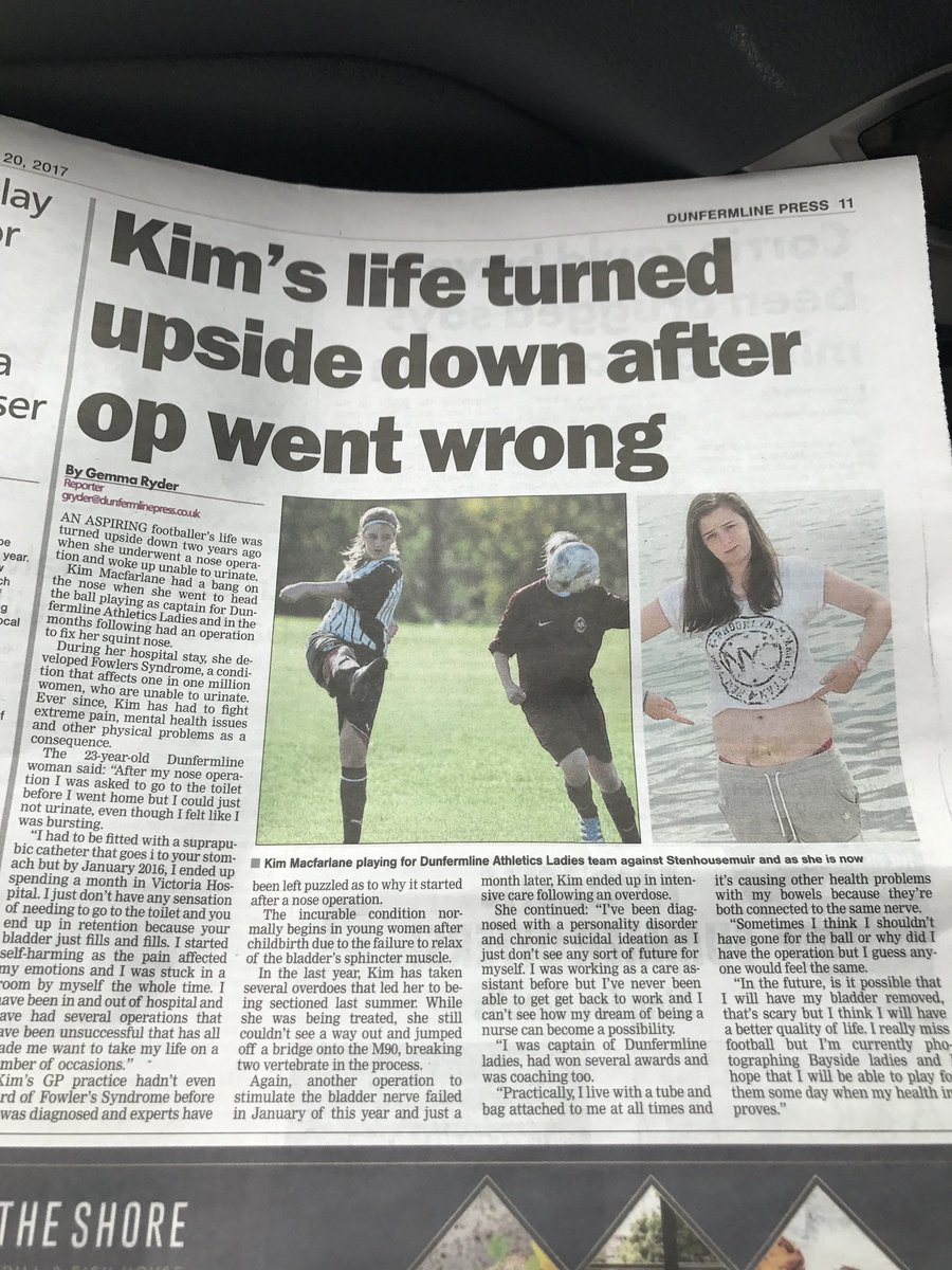 Kimmymac07's tweet photo. Exactly 3 years ago today I got the diagnosis that has changed my life. Fowler’s syndrome is such an awful condition. Unfortunately it’s not a very well known condition which makes getting treatment a whole lot harder 😔 https://t.co/rRMgZvSrxi