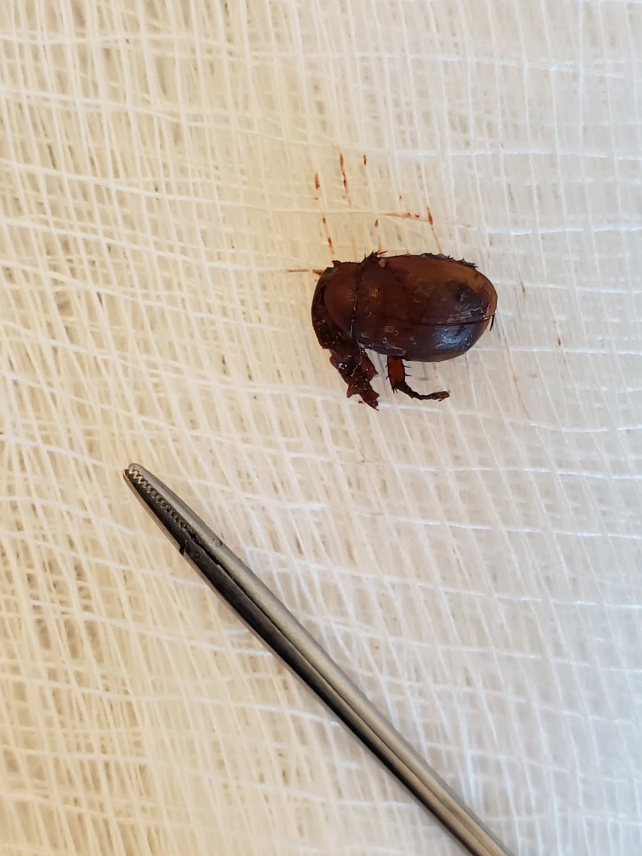 BianaLanson's tweet photo. Always a sign of the hot summer months when the ER calls you to take a big bug out of a patient's ear canal @stamfordENT! https://t.co/GgQGVGNBQI