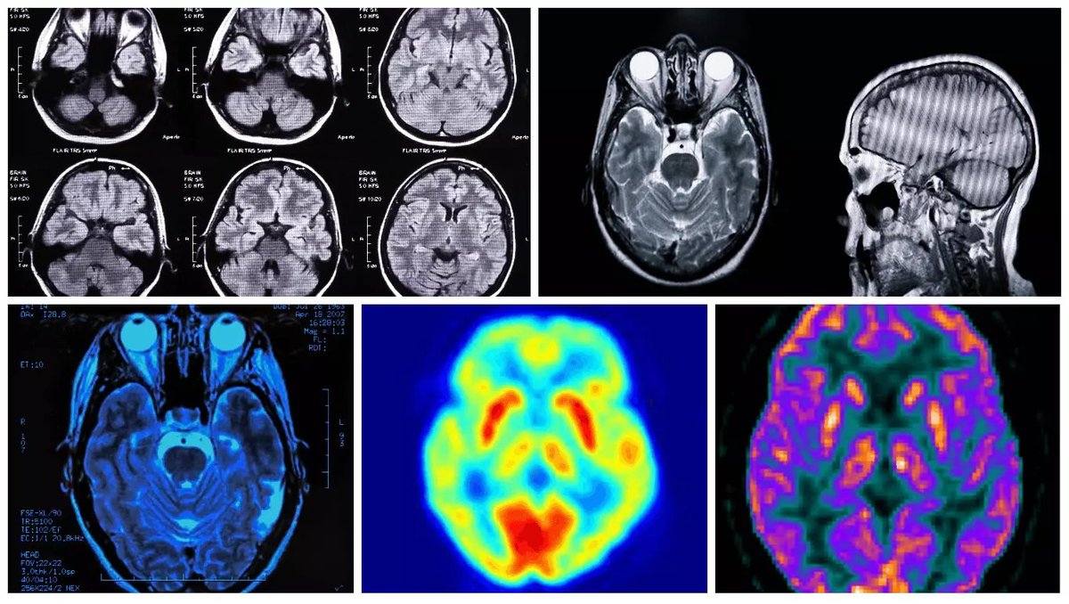 HubBucket's tweet photo. ⚕️ #MedTech 2019 | #Radiology
Two of the six recently released @CMSGov #TCPi Power Packs:
✅Understanding #Data
✅Evidence-Based Care
feature #RSCAN projects as breakthrough examples of practice transformation.
🖥️https://t.co/TB21TASYBS
@RadiologyACR @HubBucket @HubMedX https://t.co/rtlYV3Jntk