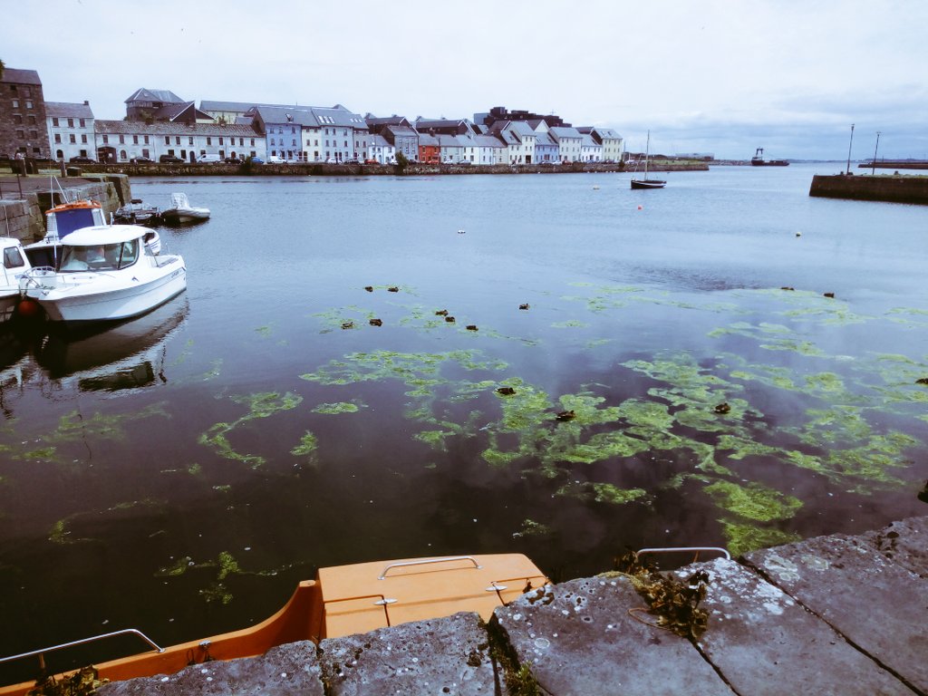 eoinsfanbase's tweet photo. To anyone who thinks you can't get a sunburn in Ireland, they are wrong ... #redasalobster #thewinddidit

The views were worth it though. 😍 #Galway https://t.co/WzZD97OURb