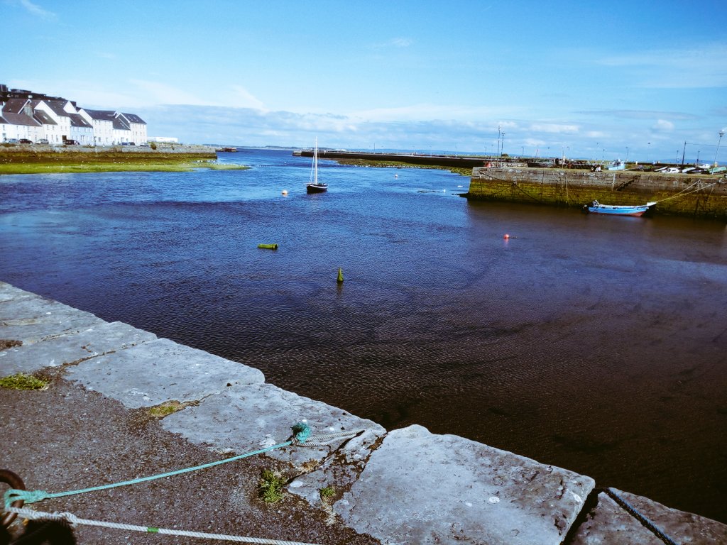 eoinsfanbase's tweet photo. To anyone who thinks you can't get a sunburn in Ireland, they are wrong ... #redasalobster #thewinddidit

The views were worth it though. 😍 #Galway https://t.co/WzZD97OURb