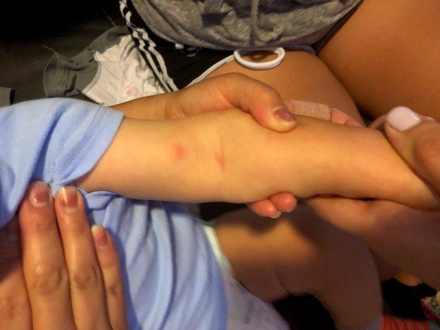 SPerkins21's tweet photo. BED BUGS!! @HamptonByHilton Milwaukee West. We stayed 2 nights &amp; left w/ Bed Bugs. 4AM Sunday morning (getting ready 2 check out) I found a bug crawling on my leg.I swatted it off &amp; look up at the ceiling and there was another one.I took pictures &amp;showed front desk. https://t.co/T4fFrJ8L1i
