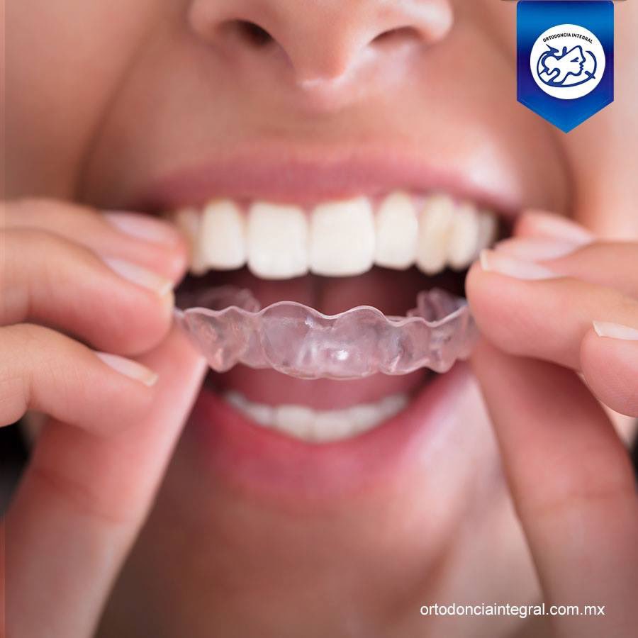 invisalignmx's tweet photo. Es el momento de decidirte a mejorar tu imagen con una gran sonrisa! https://t.co/CXvSpRMePf