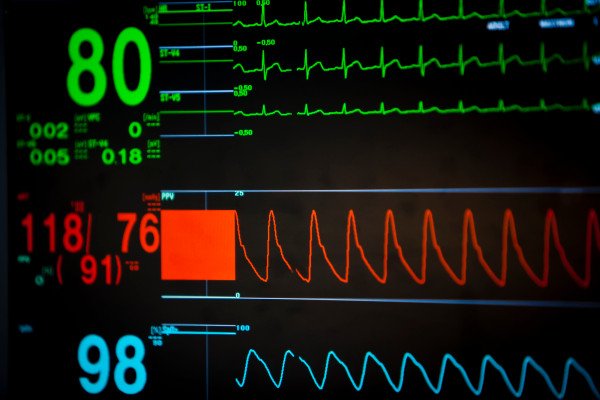 HealthDataLabs's tweet photo. Flaws in hospital anesthesia and respiratory devices allow remote tampering https://t.co/X6q00f2vd4 #technology #tech #Security https://t.co/h87ClpBH8G