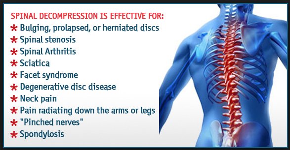 EVChiro's tweet image. Get relief with #SpinalDecompressionTreatment #NewYorkCity tinyurl.com/y4md788r #BestChiropractorNYC