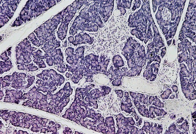 alliedmeet's tweet photo. New and Emerging Biomarkers in Endocrine Pathology.
To Know more: https://t.co/h3iaeRpkL1
#PathologyCongress #NanoPathology #PaediatricPathology #VeterinaryPathology #HistoPathology #Paris #pathology #pathologist #pathologycongress #pathologysummit #congress https://t.co/rBFoDRExgx