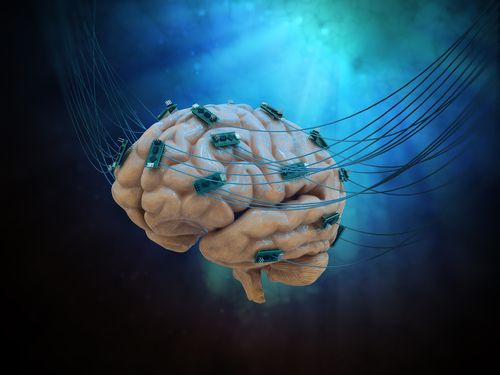 New Post: Glial Cells Overly Activated in Brains of Fibromyalgia Patients to Promote Inflammation, Study Suggests buff.ly/2Lf5lDU