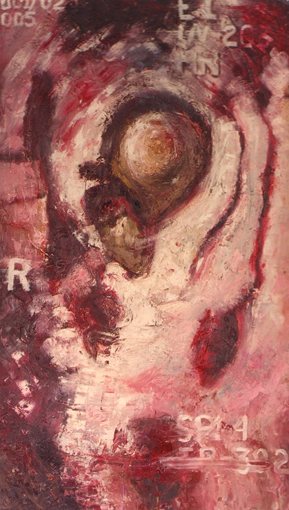 HuacujaVeronica's tweet photo. Title: Kidney's upper pole mass
Artist: Veronica Huacuja
Medium: Oil with marble powder on canvas
Size: 46 x 25.3 x 4 cm
Year: 2000
The terms mass, tumor or lesion are used to describe an abnormal growth in the kidney. I invite you to operate with this artwork.
#itondo https://t.co/istgXE143h