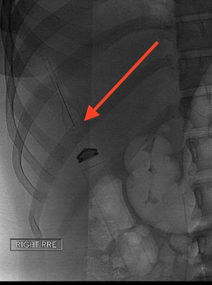 Nathan Ertel MD tweet media