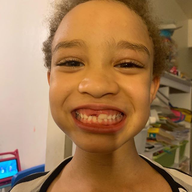 MamaRae2's tweet image. Tooth 🦷 number four is out #toothfairy #fronttooth #babytooth ift.tt/2LLVbtz