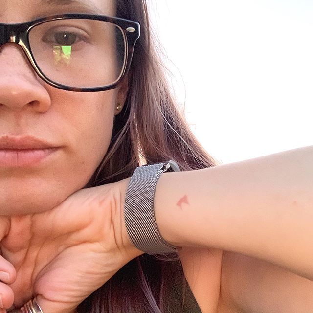 summerbukeavich's tweet image. “B” is for “burn”. #literalburn #campingproblems ift.tt/2JFIiyv