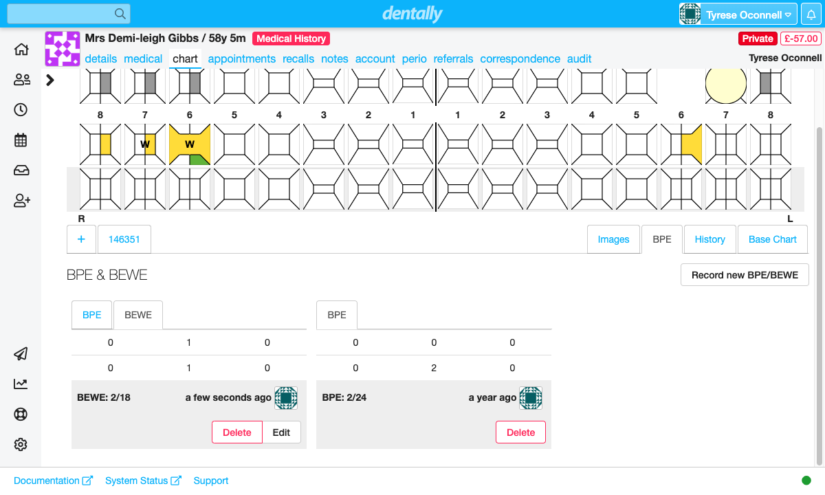 DentallyApp's tweet photo. Did you know we have now added the option to record a Basic Erosive Wear Examination (BEWE) within Dentally?  Learn more here: https://t.co/X9ZqpguupZ

#patientmanagementsoftware #dentistry #BEWE https://t.co/bJkkirIbSQ
