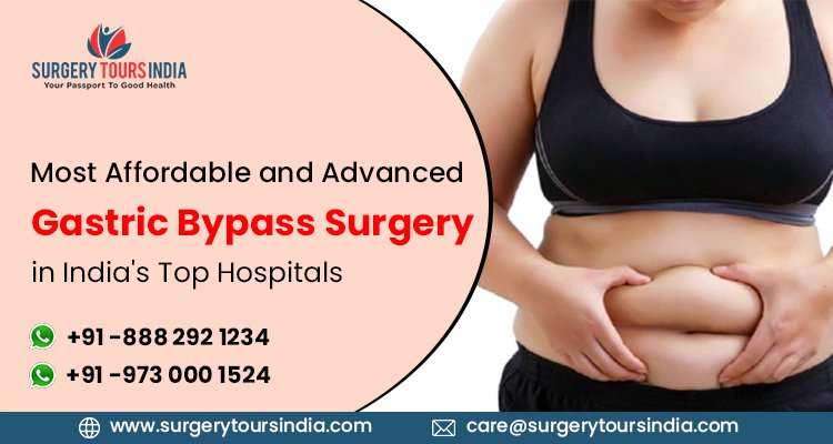 surgery_tour's tweet photo. #Surgery Tours India offers affordable cost #Gastric Bypass Surgery in India's Top Hospitals with world class Gastric Bypass Surgery facilities. Book an appointment now. Call: +91-8882921234 | +91-9730001540
Visit: https://t.co/rj19KzTHil
#gastricbypass #surgery #bariatric https://t.co/KbthxcZhqa