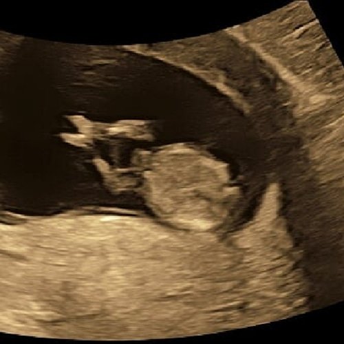 My sweet baby growing healthy n strong I'm so in love https://t.co/UgX1wm2xzs