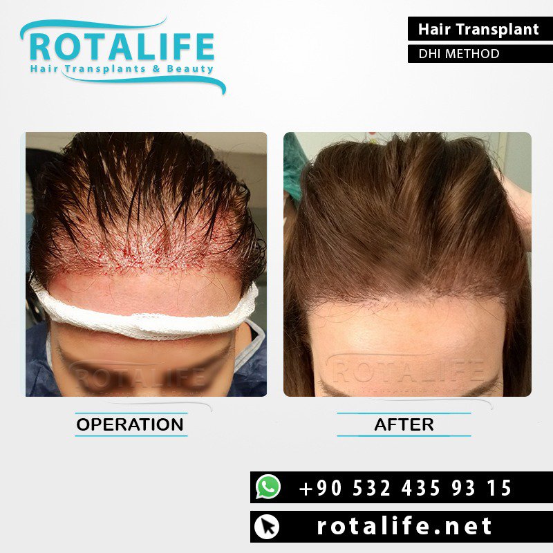 RotlifeHair on Twitter: RotlifeHair on Twitter: