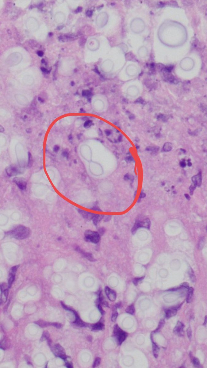 Sanjay Mukhopadhyay on Twitter: