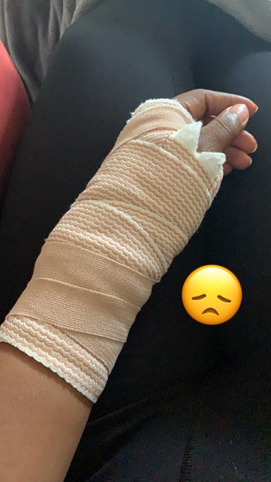 I had wrist surgery 😔 https://t.co/YeVVVJXeSh