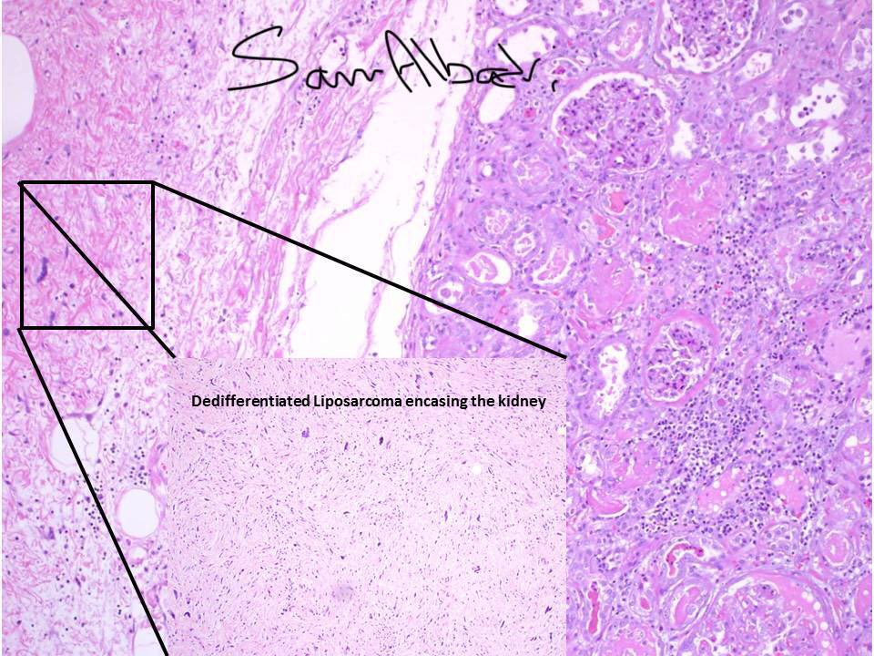 MPAlexanderMD tweet picture